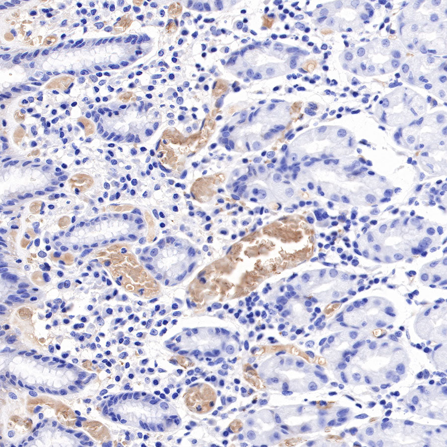 Hemoglobin Recombinant Rabbit mAb (SDT-193-71)