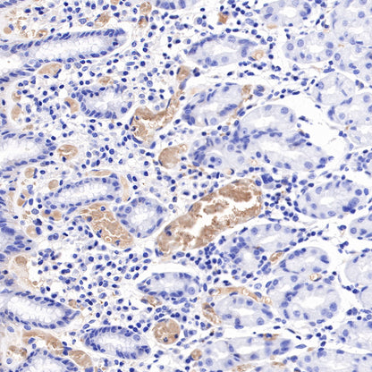 Hemoglobin Recombinant Rabbit mAb (SDT-193-71)