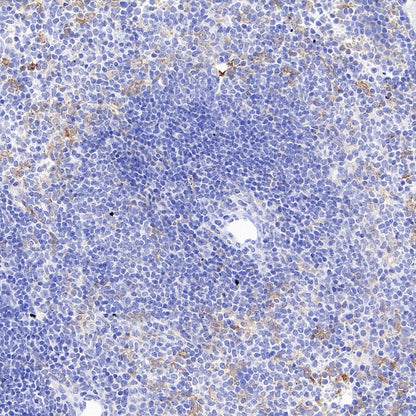 CSF-1R Rabbit Polyclonal Antibody