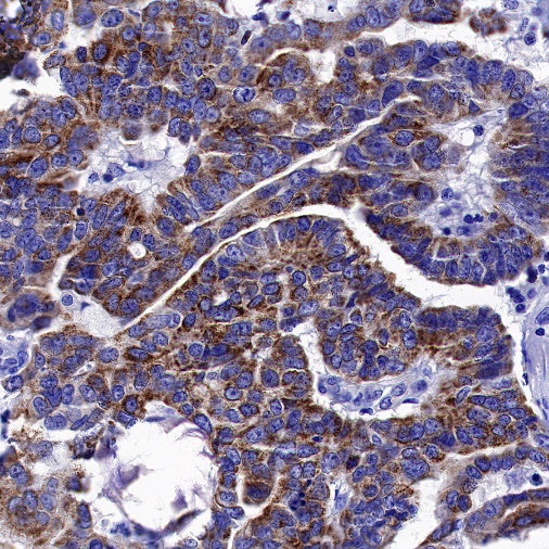 Bim Recombinant Rabbit mAb (S-994-29)