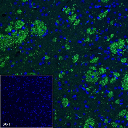 Caspr Recombinant Rabbit mAb (S-1706-1)