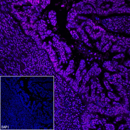 TEL1 Recombinant Rabbit mAb (S-3067-60)