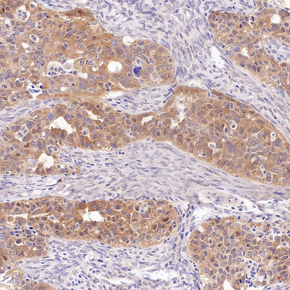 PRMT5 Recombinant Rabbit mAb (S-2336-126)