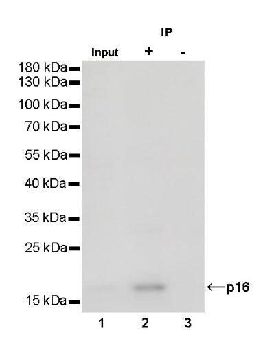 p16 Recombinant Rabbit mAb (S-303-1)