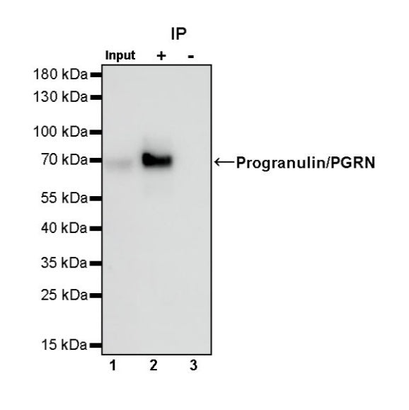 Progranulin/PGRN Recombinant Rabbit mAb (S-1090-110)