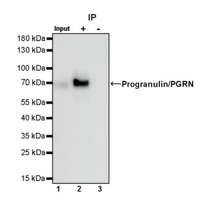 Progranulin/PGRN Recombinant Rabbit mAb (S-1090-110)