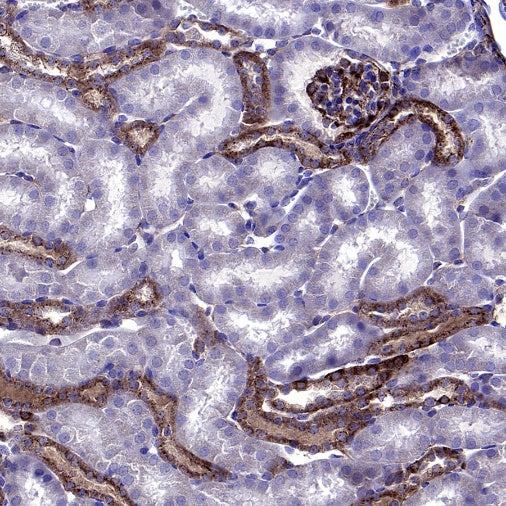 VAMP2 Recombinant Rabbit mAb (S-2359-2)
