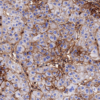 HLA-A Rabbit Polyclonal Antibody