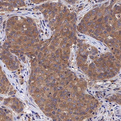 ATIC Rabbit Polyclonal Antibody