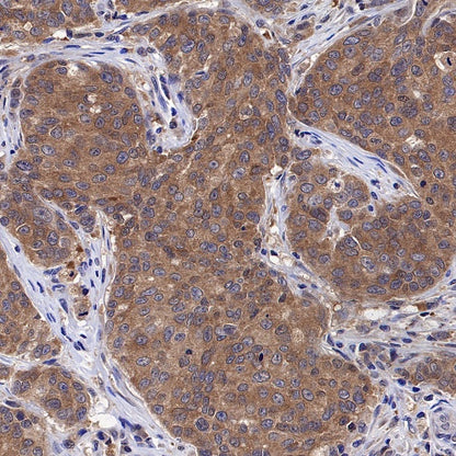 ATIC Rabbit Polyclonal Antibody