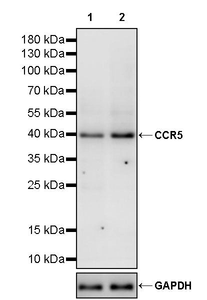CCR5 Recombinant Rabbit mAb (S-2467-54)