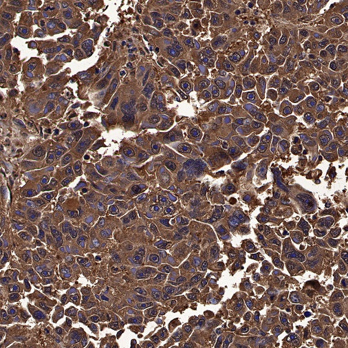 Peroxiredoxin 6 Rabbit Polyclonal Antibody