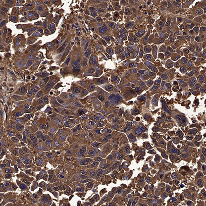 Peroxiredoxin 6 Rabbit Polyclonal Antibody