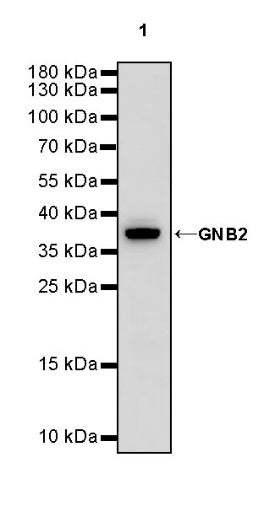 GNB2 Recombinant Rabbit mAb (S-645-10)