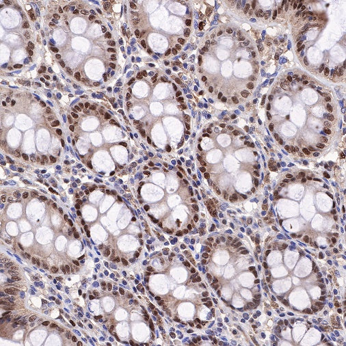 SQSTM1/p62 Recombinant Rabbit mAb (S-778-1)