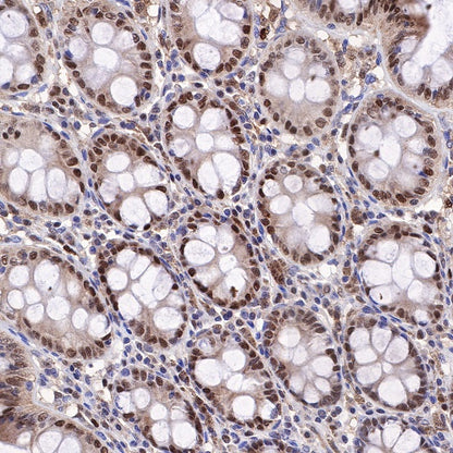 SQSTM1/p62 Recombinant Rabbit mAb (S-778-1)