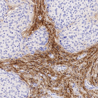 Versican Recombinant Rabbit mAb (S-3770-43)