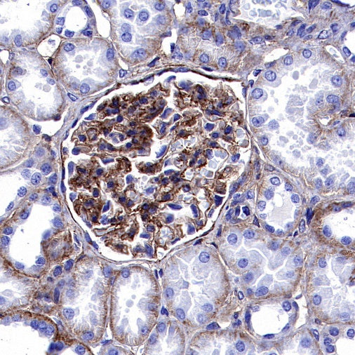 Integrin beta1/CD29 Recombinant Rabbit mAb (SDT-255-52)