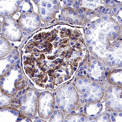 Integrin beta1/CD29 Recombinant Rabbit mAb (SDT-255-52)
