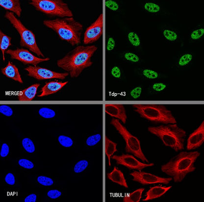TDP-43 Recombinant Rabbit mAb (S-989-41)