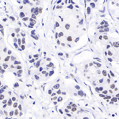 Anti-5-methylcytosine (5-mC) Recombinant Mouse mAb (S-3720)