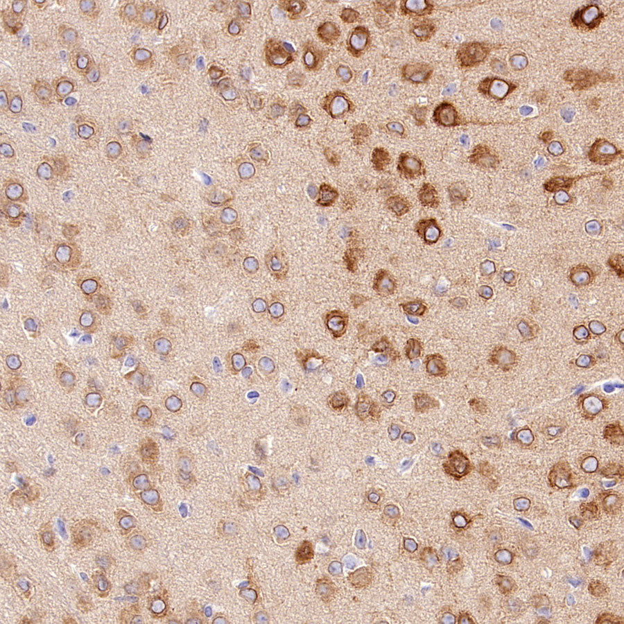 CDS1 Recombinant Rabbit mAb (S-3671-30)
