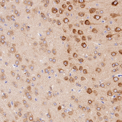 CDS1 Recombinant Rabbit mAb (S-3671-30)