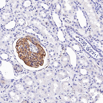 Synaptopodin Recombinant Rabbit mAb (SDT-3331-4)