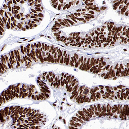 ENT2 Rabbit Polyclonal Antibody