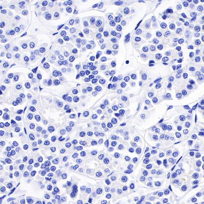 N-Cadherin Recombinant Rabbit mAb (SDT-329-12)