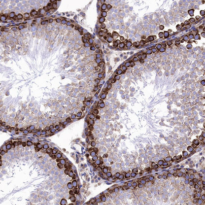 YTHDF2 Recombinant Rabbit mAb (S-1569-42)