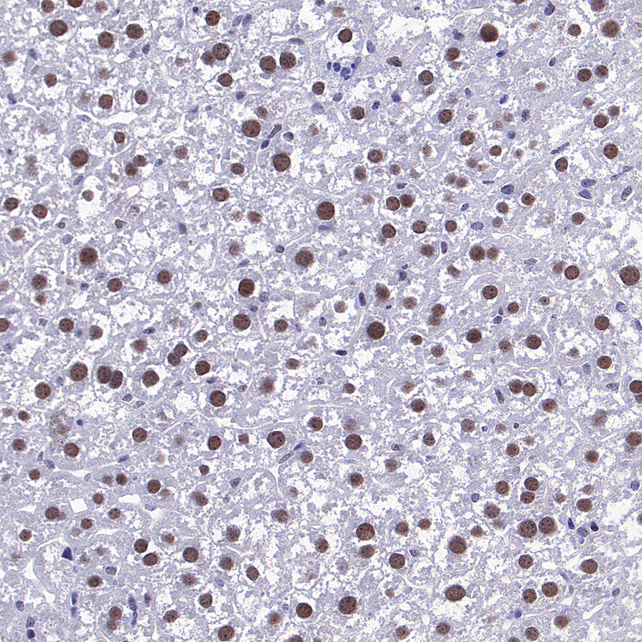 METTL1 Recombinant Rabbit mAb (S-4435-6)