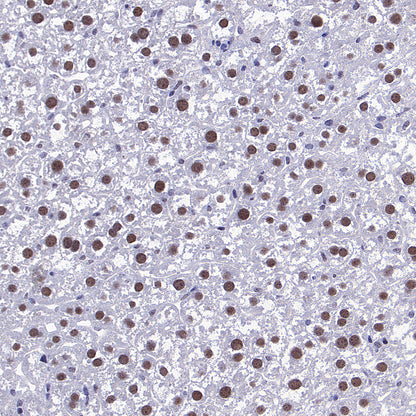 METTL1 Recombinant Rabbit mAb (S-4435-6)
