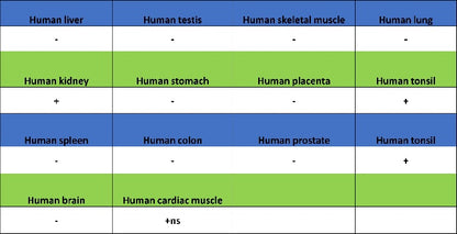 B7-H6 Recombinant Rabbit mAb (SDT-3241-6)