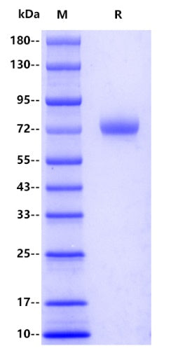 Human ANGPT2 Protein, His tag