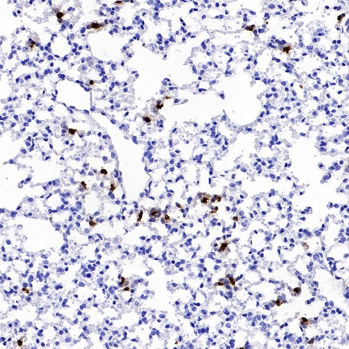 Lipocalin-2/NGAL Recombinant Rabbit mAb (S-2280-129)