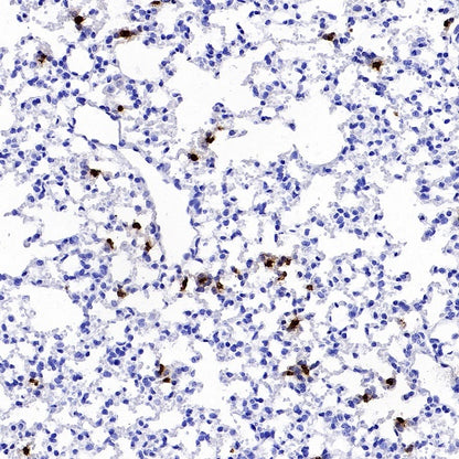 Lipocalin-2/NGAL Recombinant Rabbit mAb (S-2280-129)