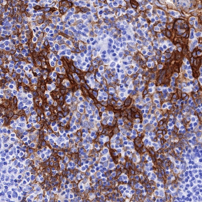 TACSTD2/TROP2 Recombinant Rabbit mAb (S-R238)