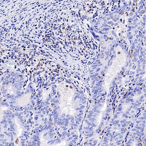 TGF beta 1 Recombinant Rabbit mAb (S-3204)