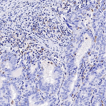 TGF beta 1 Recombinant Rabbit mAb (S-3204)