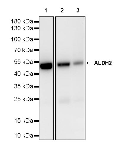 ALDH2 Mouse mAb