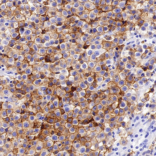 ALPG Rabbit Polyclonal Antibody