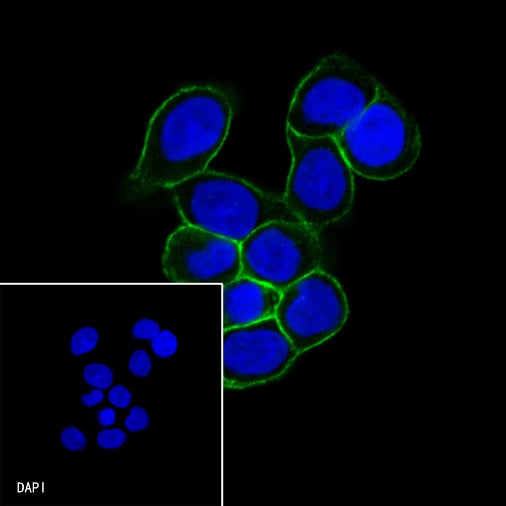 S-RMab® E-Cadherin Recombinant Rabbit mAb (SDT-438-5)