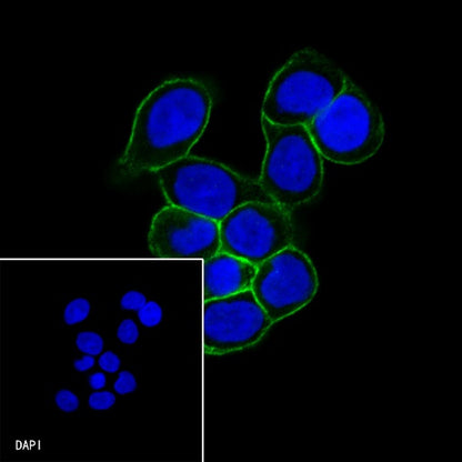 S-RMab® E-Cadherin Recombinant Rabbit mAb (SDT-438-5)