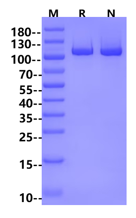 ACSS2 GST Tag Protein, Human