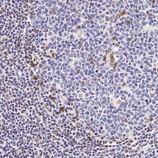 Bmi1 Recombinant Rabbit mAb (S-3313-71)