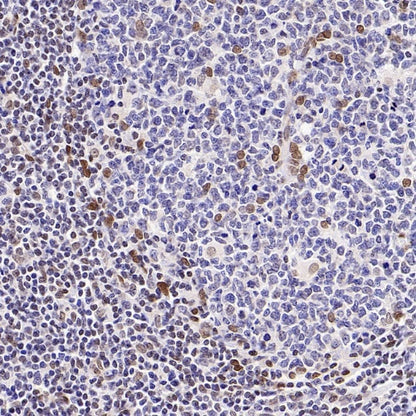 Bmi1 Recombinant Rabbit mAb (S-3313-71)