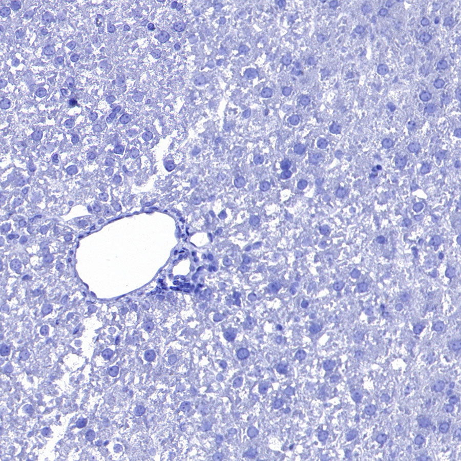 SLC7A5 Recombinant Rabbit mAb (S-4496-55)