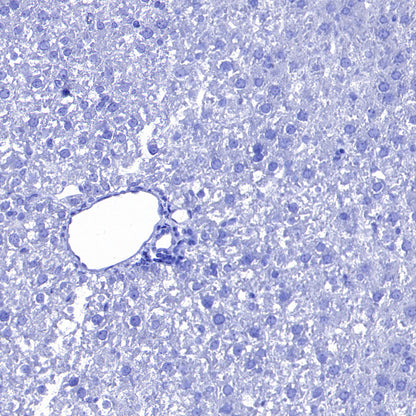 SLC7A5 Recombinant Rabbit mAb (S-4496-55)