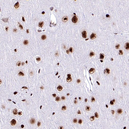 ARID1A Recombinant Rabbit mAb (S-440-62)